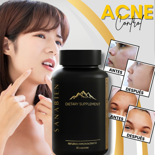 AcneControl