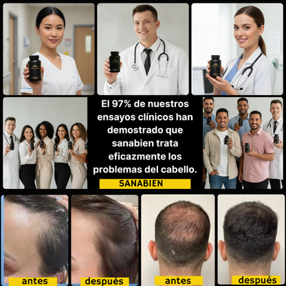 HairRegen